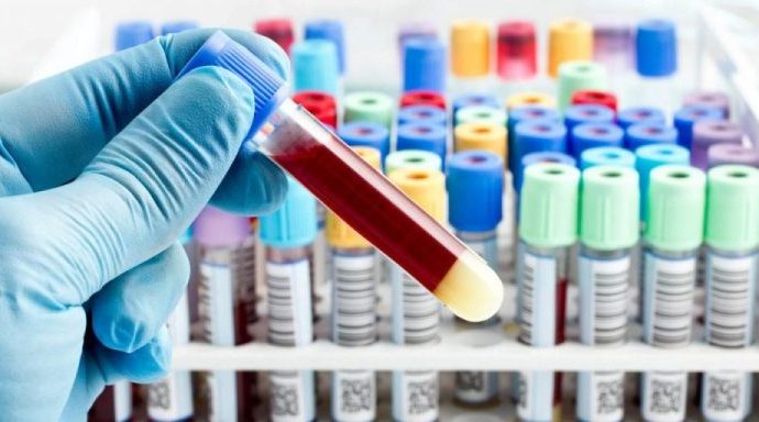 COLETAS DE EXAMES LABORATORIAIS EM ANDRADINA