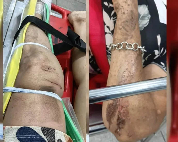Prisão preventiva de suspeito de agressão a médica e atropelamento de idosa em Santa Fé do Sul