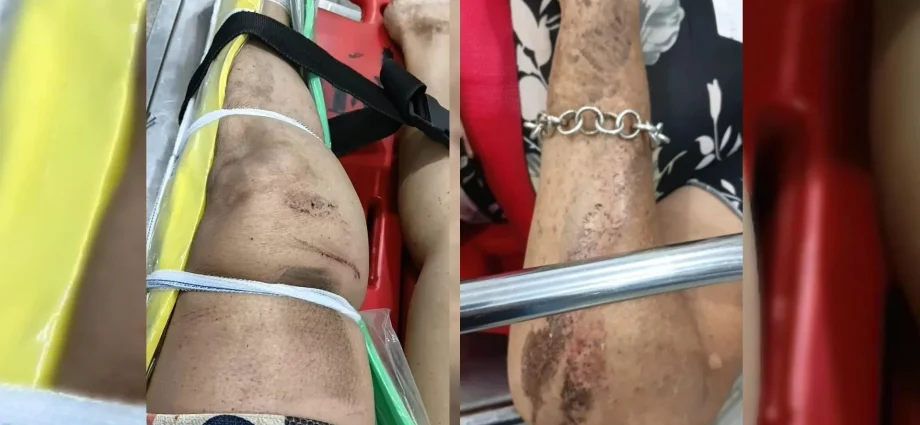 Prisão preventiva de suspeito de agressão a médica e atropelamento de idosa em Santa Fé do Sul